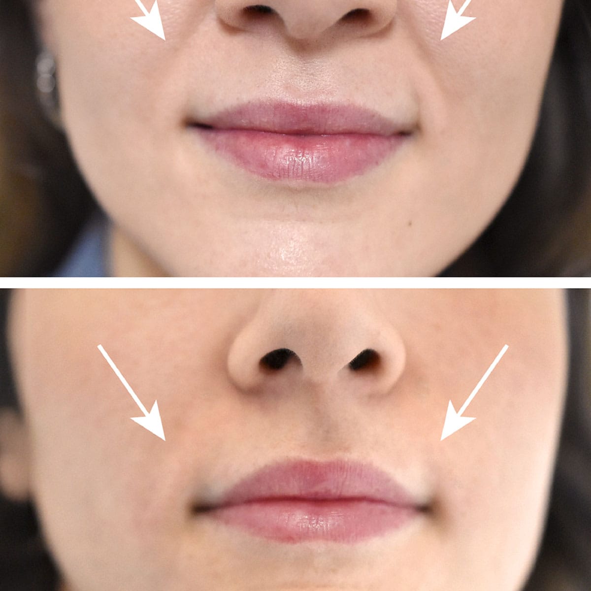 London Lip Clinic — photo 2