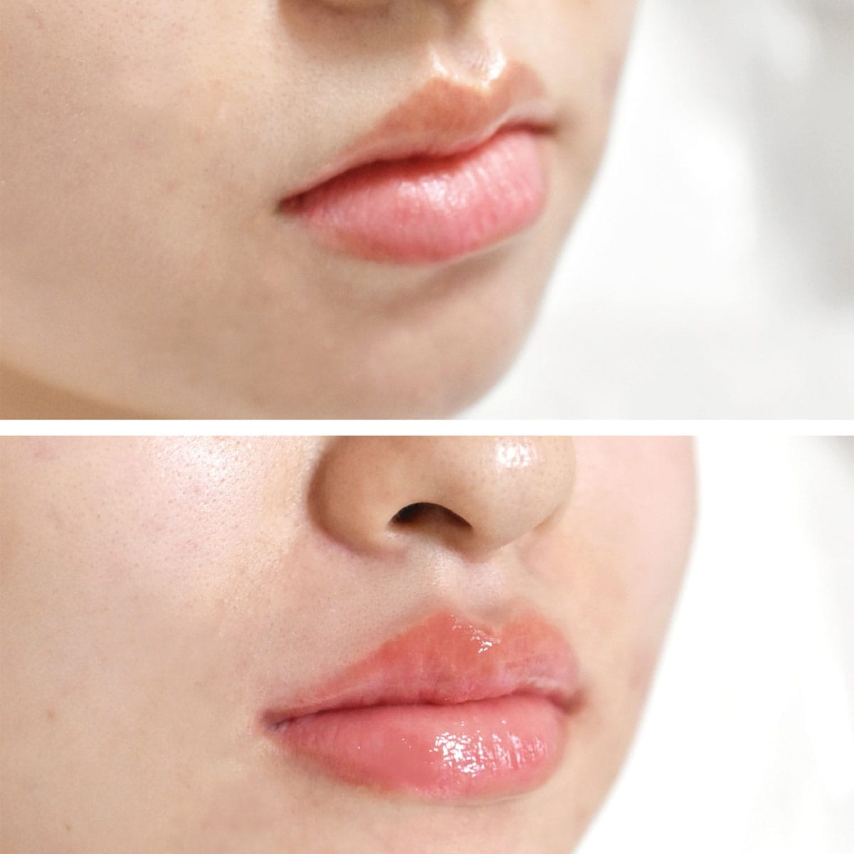 London Lip Clinic — photo 3