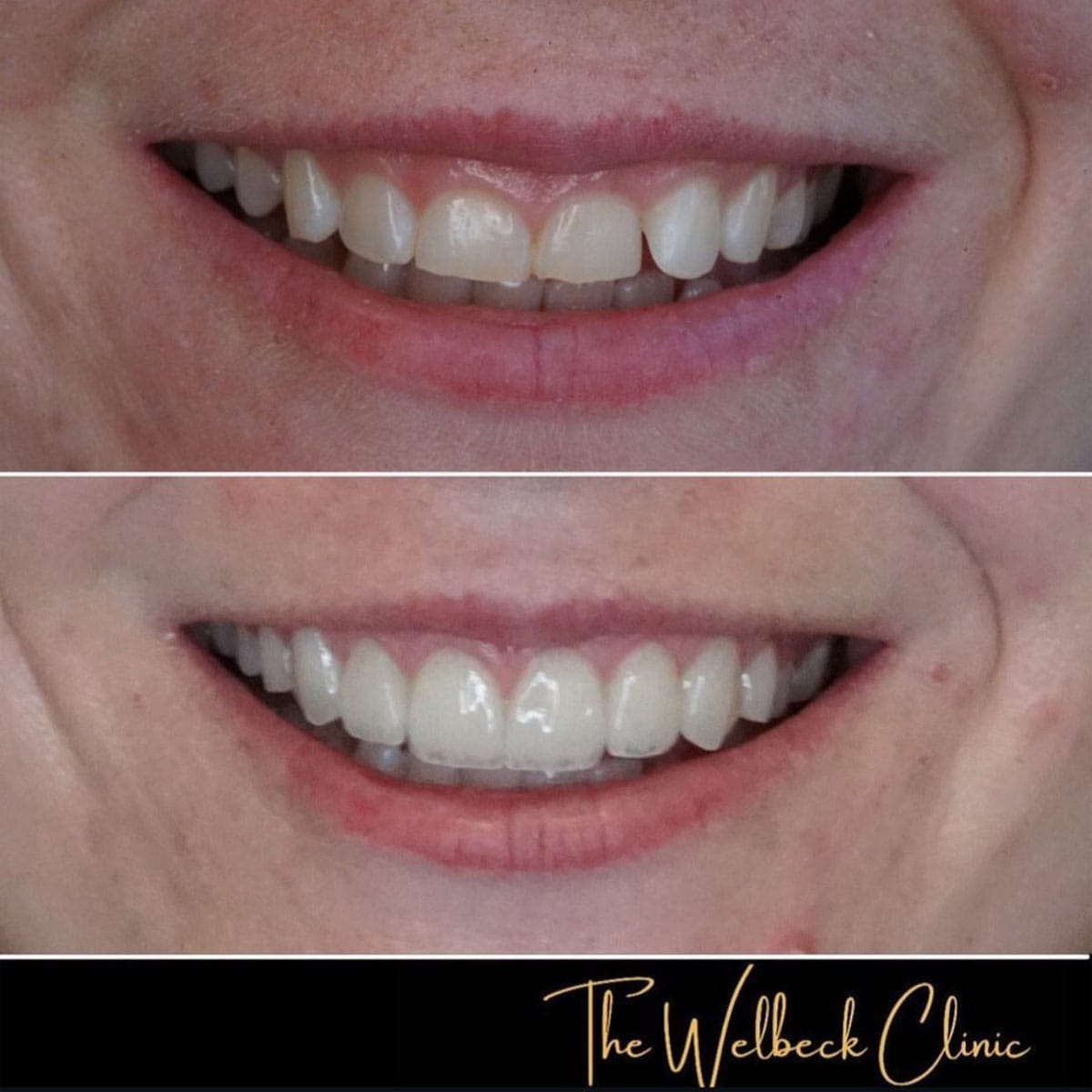 The Welbeck Clinic - Cosmetic Dentist London — photo 2