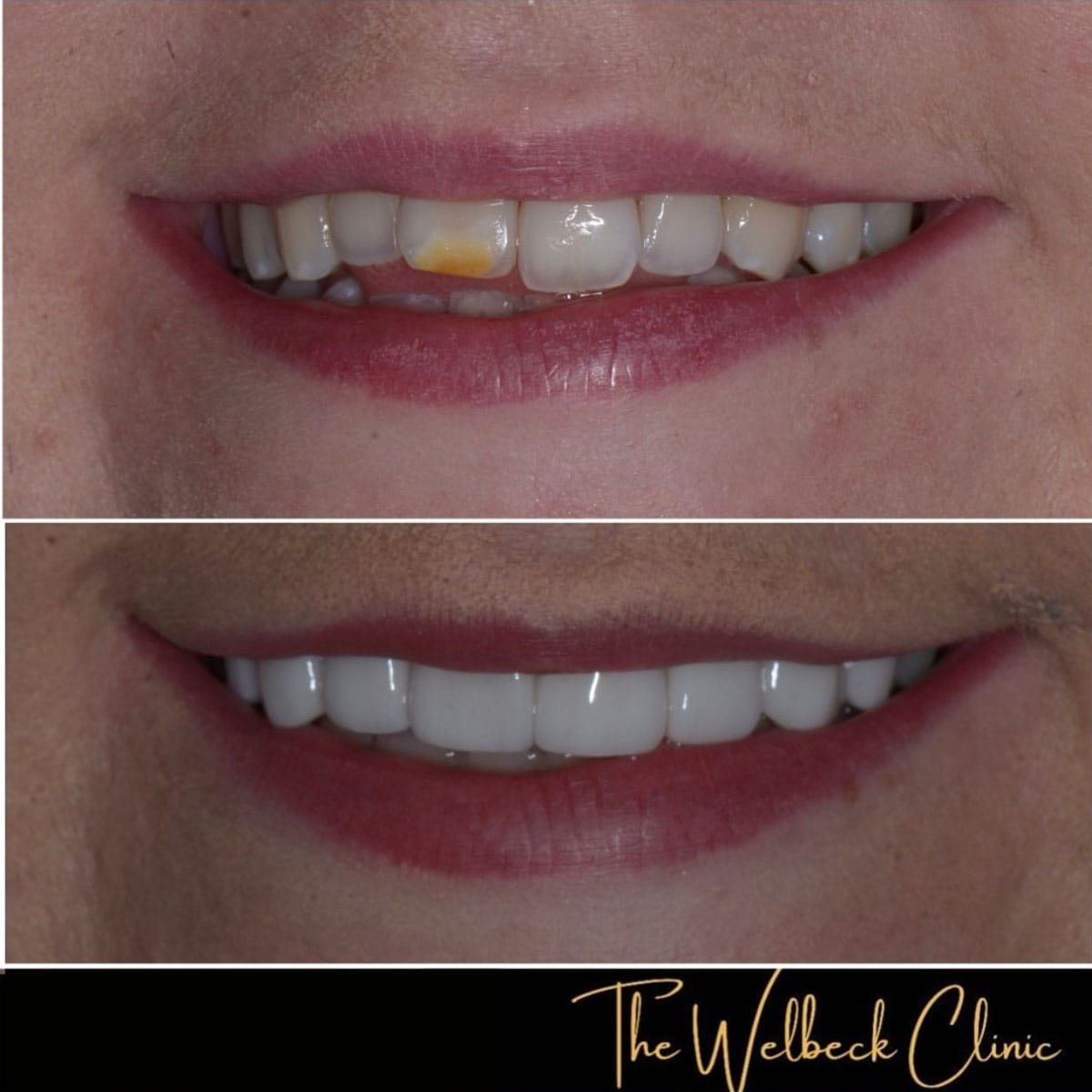 The Welbeck Clinic - Cosmetic Dentist London — photo 3