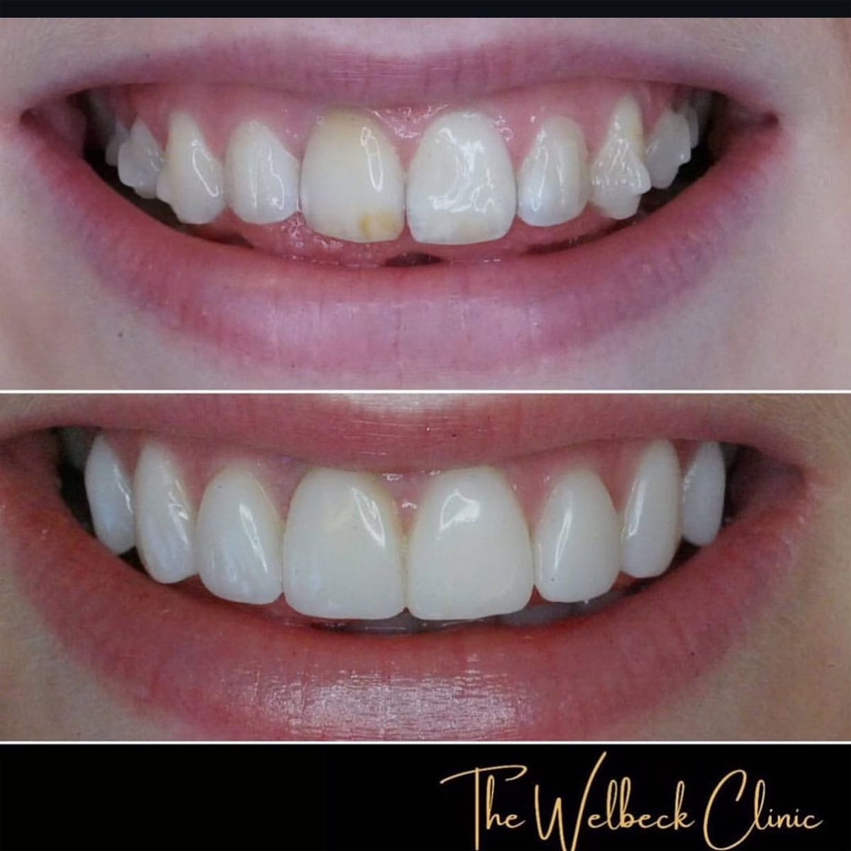The Welbeck Clinic - Cosmetic Dentist London — photo 4
