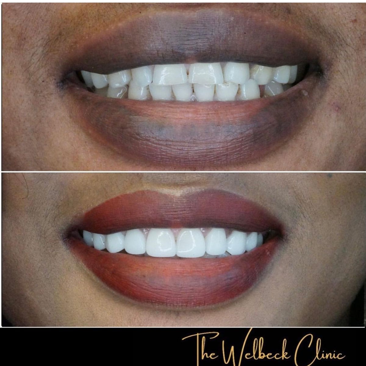 The Welbeck Clinic - Cosmetic Dentist London — photo 1