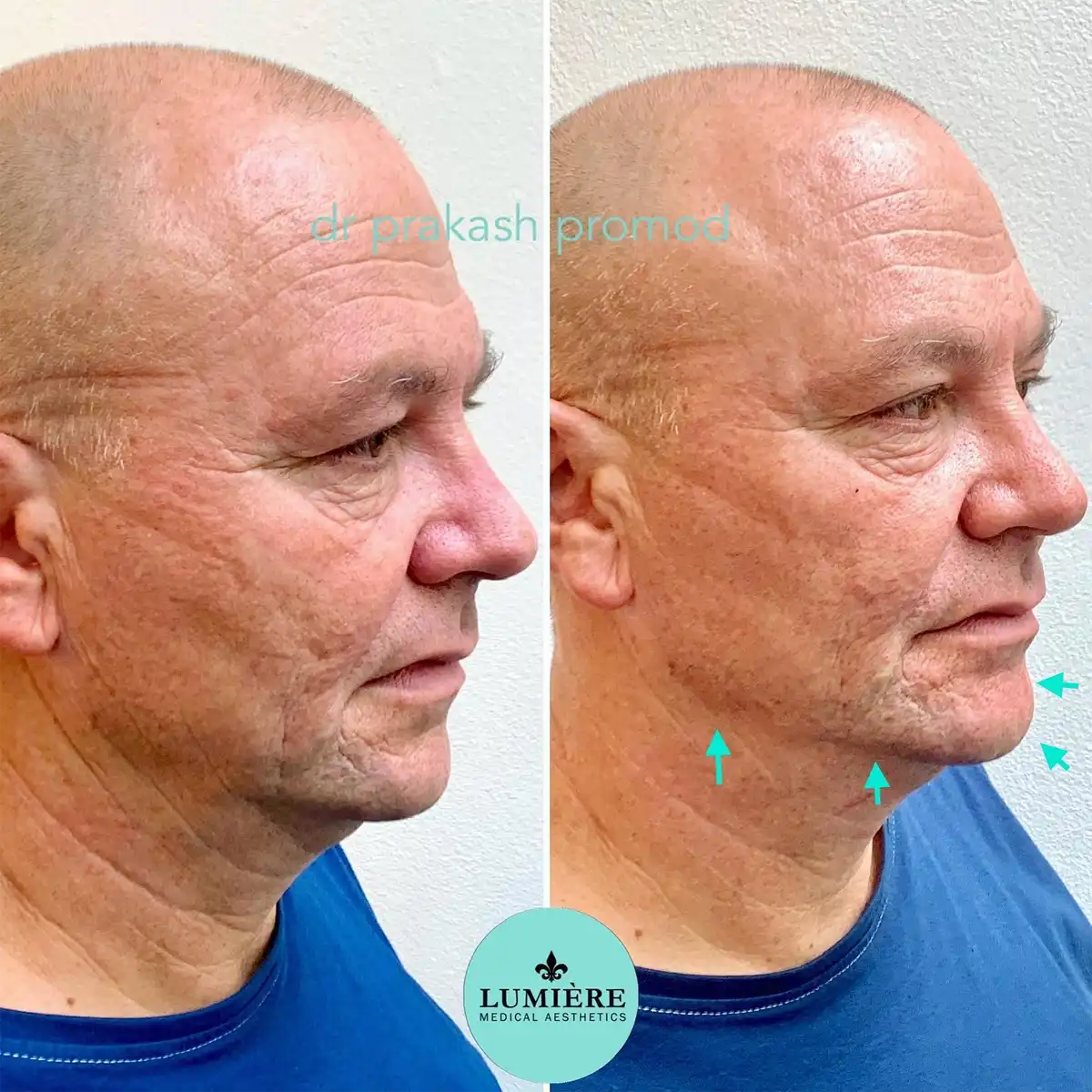 Lumière Medical Aesthetics photo 2