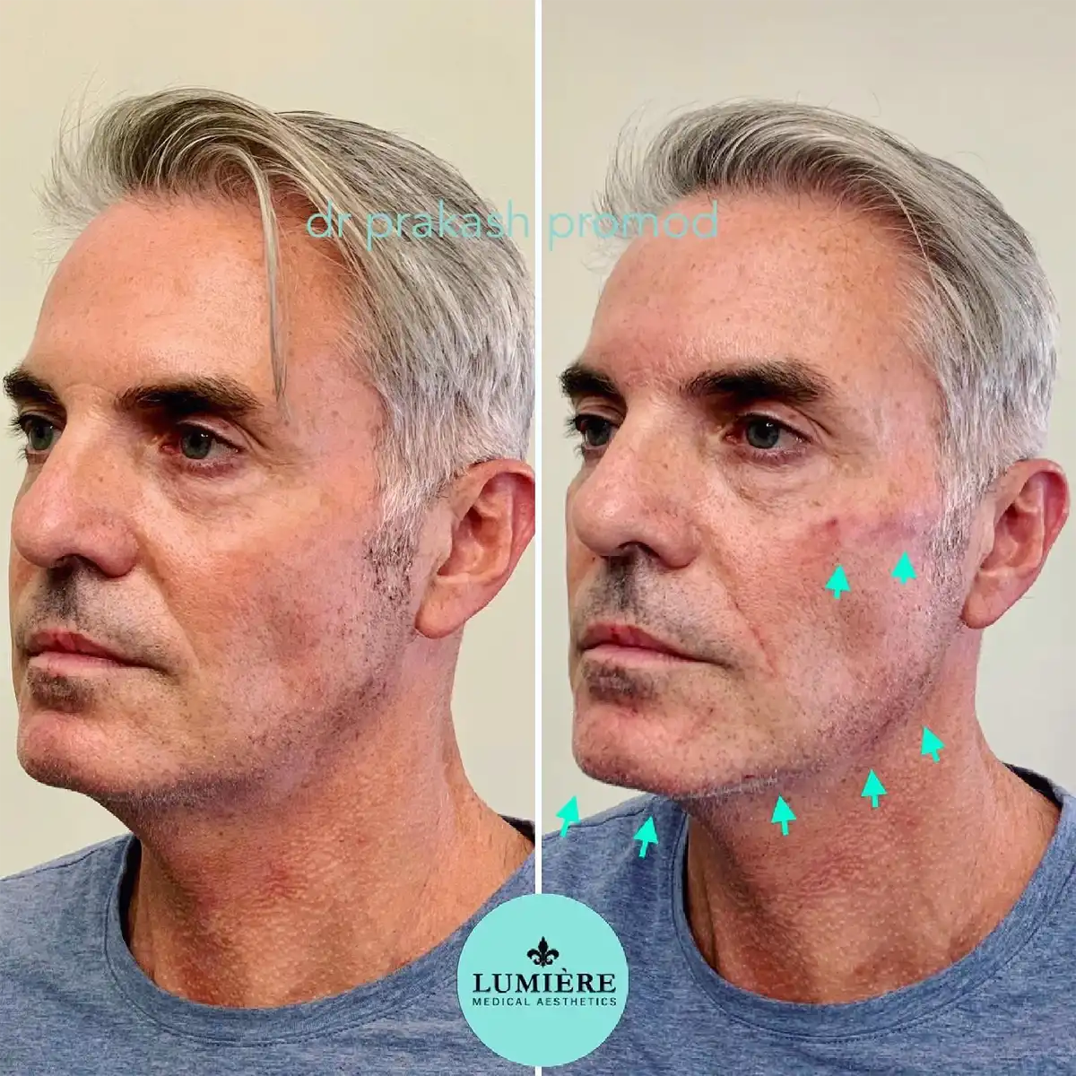 Lumière Medical Aesthetics photo 4