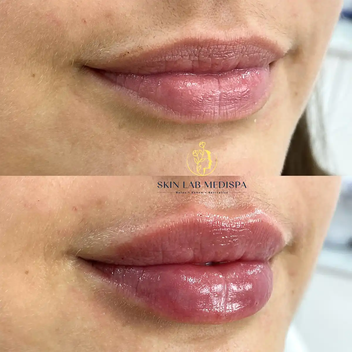 Skin Lab Medispa — photo 2