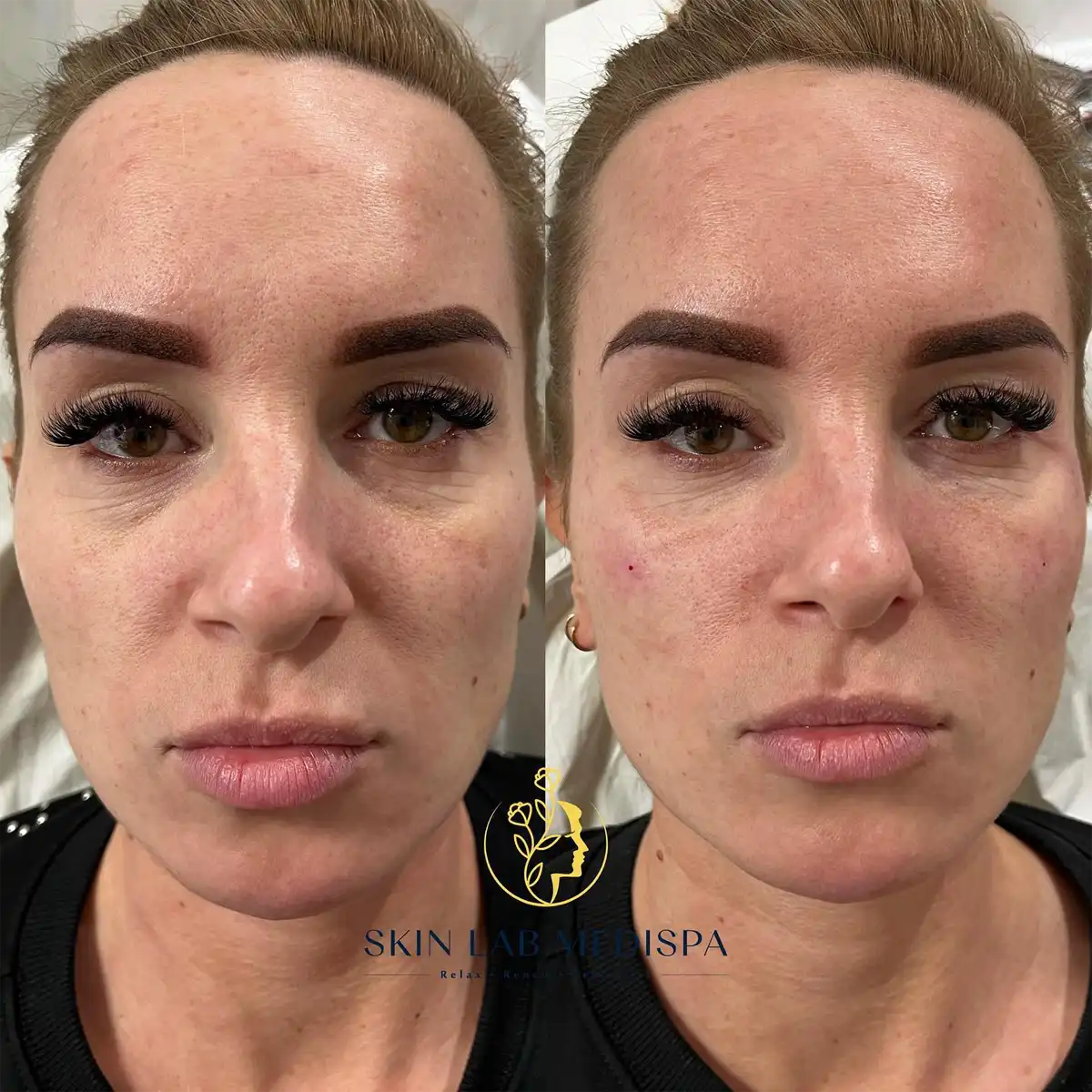 Skin Lab Medispa — photo 4