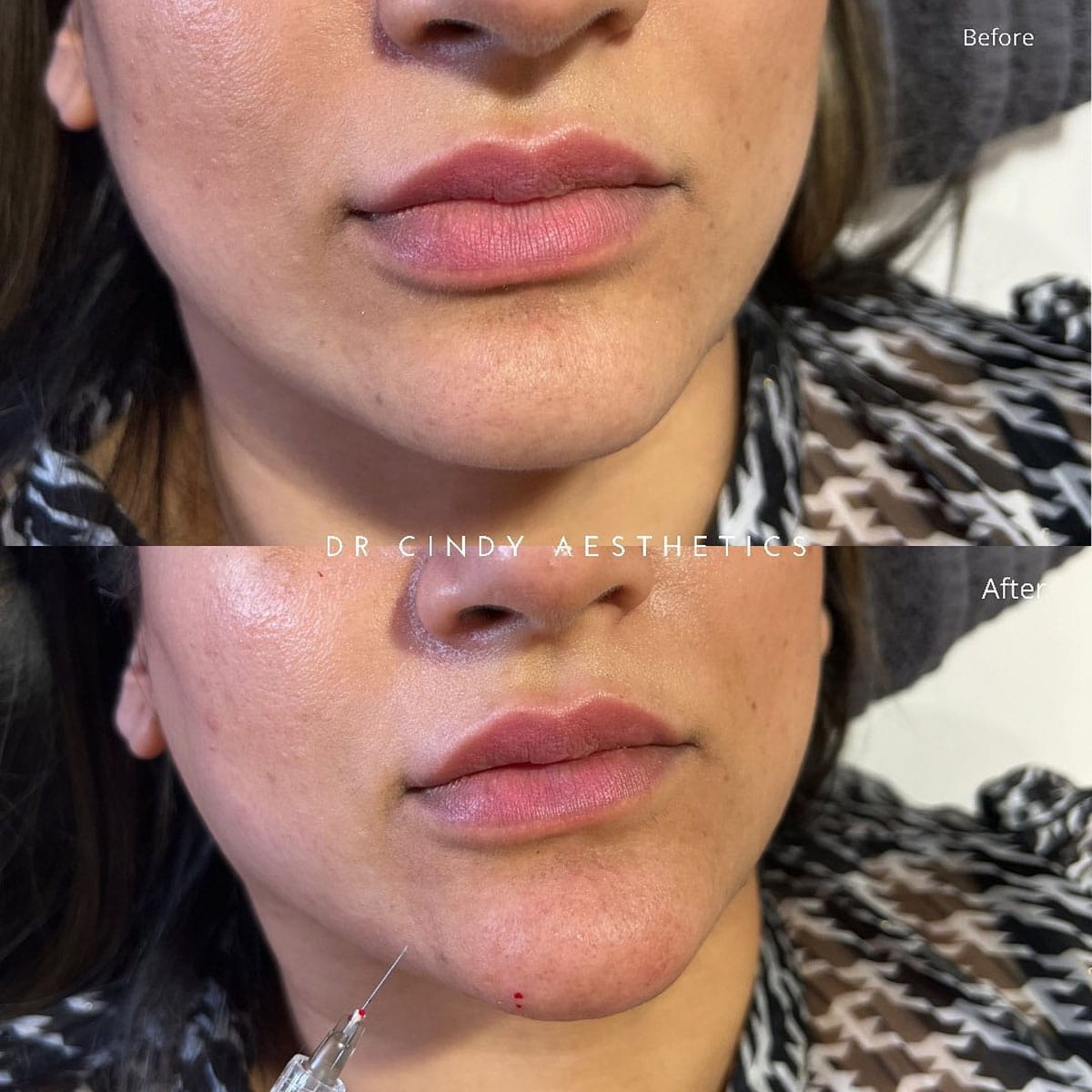 Dr Cindy Aesthetics Clinic — photo 4