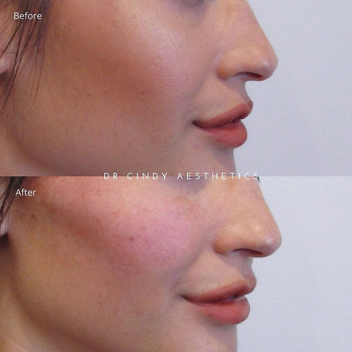 Dr Cindy Aesthetics Clinic — photo 1